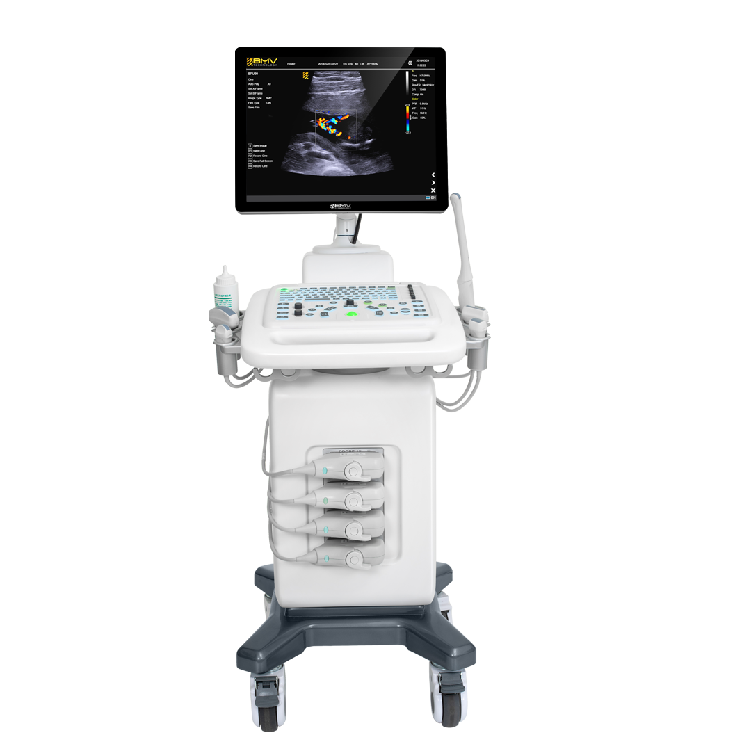 Trolley Color Doppler Ultrasound Machine I Model MUCD7