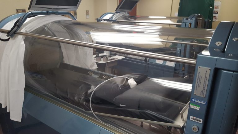 Monoplace Hyperbaric Chamber 3 ATA for Sale – Oxygen Therapy Chamber HBOT Unit